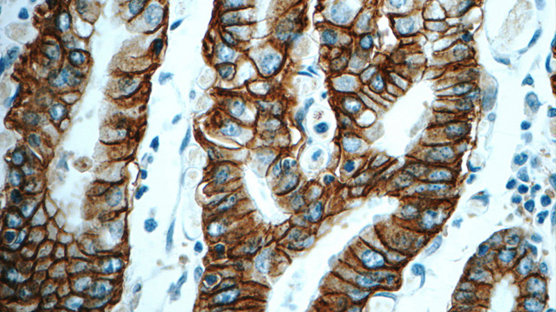 Immunohistochemistry of paraffin-embedded human stomach tissue slide using Catalog No:107159 (CLDN18 Antibody) at dilution of 1:600 (under 40x lens)