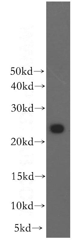 human brain tissue were subjected to SDS PAGE followed by western blot with Catalog No:114428(RAB2B antibody) at dilution of 1:800