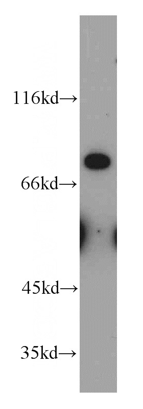 HEK-293 cells were subjected to SDS PAGE followed by western blot with Catalog No:112528(MFI2 antibody) at dilution of 1:100