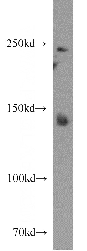 mouse liver tissue were subjected to SDS PAGE followed by western blot with Catalog No:110430(F5 antibody) at dilution of 1:1000