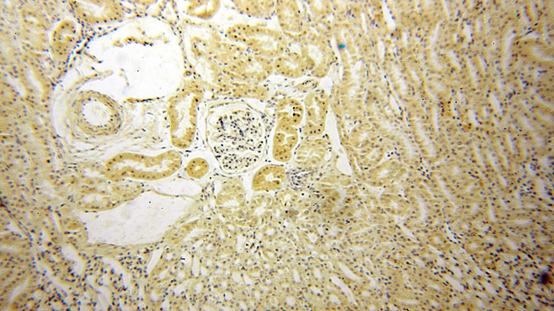 Immunohistochemical of paraffin-embedded human kidney using Catalog No:112859(MRPS36 antibody) at dilution of 1:50 (under 10x lens)