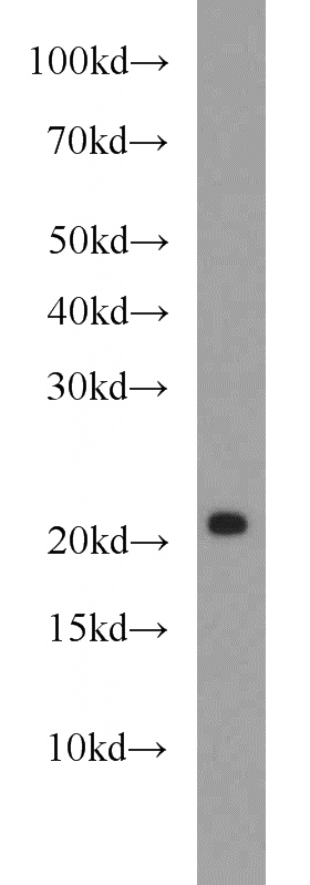 mouse brain tissue were subjected to SDS PAGE followed by western blot with Catalog No:114679(REEP1 antibody) at dilution of 1:1000