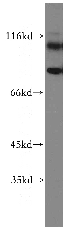 Y79 cells were subjected to SDS PAGE followed by western blot with Catalog No:109049(PROM1-1,2,3 antibody) at dilution of 1:100