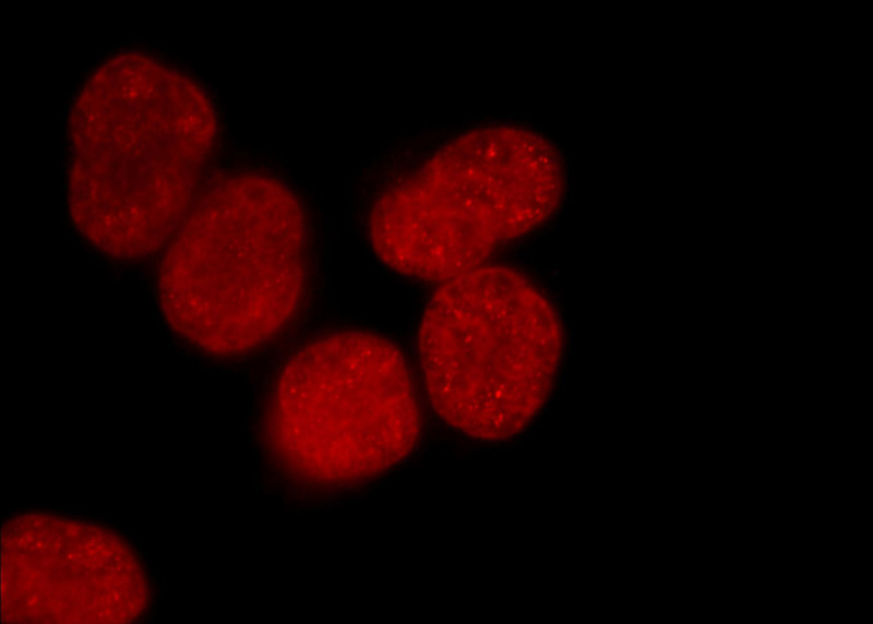 Immunofluorescent analysis of HEK-293 cells using Catalog No:117326(Histone-H3 Antibody) at dilution of 1:50 and Rhodamine-Goat anti-Rabbit IgG