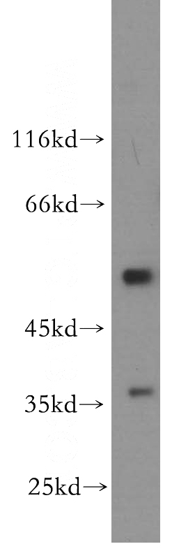 HeLa cells were subjected to SDS PAGE followed by western blot with Catalog No:111630(IFRD1 antibody) at dilution of 1:600