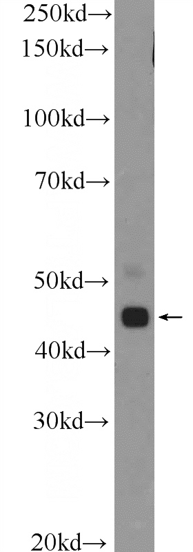 mouse testis tissue were subjected to SDS PAGE followed by western blot with Catalog No:116481(TTLL10 Antibody) at dilution of 1:1000