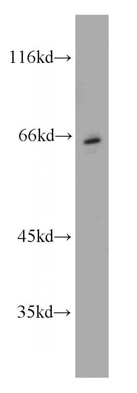 mouse brain tissue were subjected to SDS PAGE followed by western blot with Catalog No:109302(SLC5A7 antibody) at dilution of 1:300