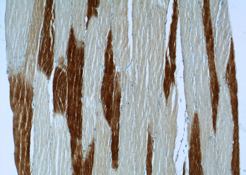 Immunohistochemistry of paraffin-embedded human skeletal muscle slide using Catalog No:116153(TNNI2 Antibody) at dilution of 1:50
