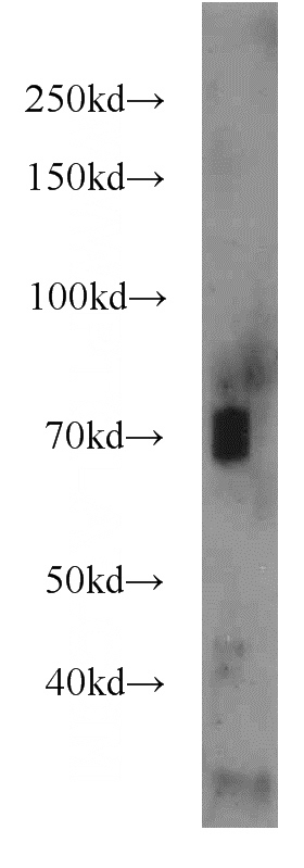 mouse kidney tissue were subjected to SDS PAGE followed by western blot with Catalog No:108003(AMPD3 antibody) at dilution of 1:1000