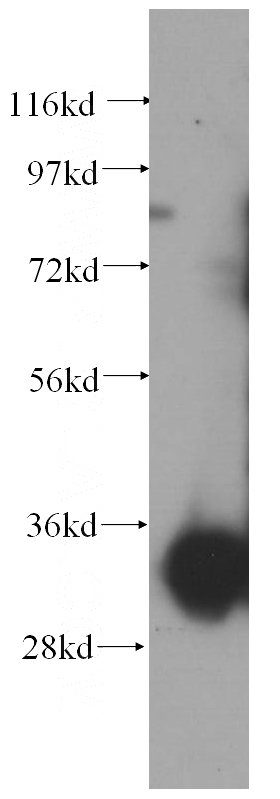 human placenta tissue were subjected to SDS PAGE followed by western blot with Catalog No:109656(CYB5R1 antibody) at dilution of 1:500
