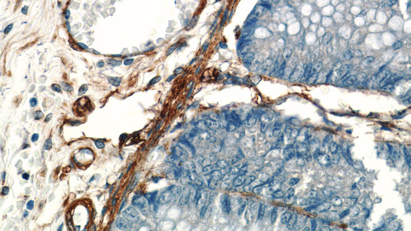 Immunohistochemistry of paraffin-embedded human colon tissue slide using Catalog No:107930(AKAP12 Antibody) at dilution of 1:50 (under 40x lens)
