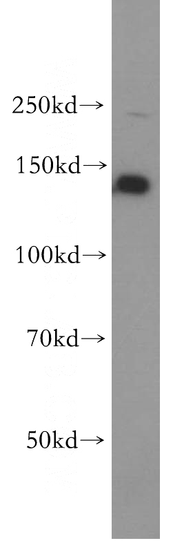 HEK-293 cells were subjected to SDS PAGE followed by western blot with Catalog No:114249(PSME4 antibody) at dilution of 1:400