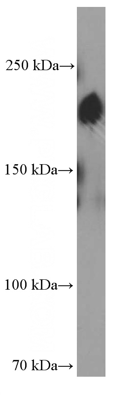 HeLa cells were subjected to SDS PAGE followed by western blot with Catalog No:107548(ZEB1 Antibody) at dilution of 1:1000