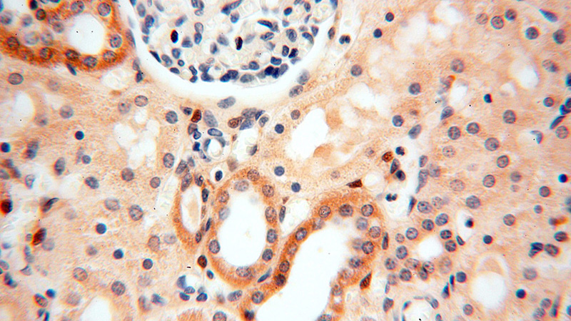 Immunohistochemical of paraffin-embedded human kidney using Catalog No:107788(ADH4 antibody) at dilution of 1:50 (under 40x lens)