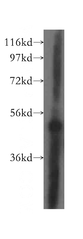 HepG2 cells were subjected to SDS PAGE followed by western blot with Catalog No:116459(TXNRD2 antibody) at dilution of 1:400