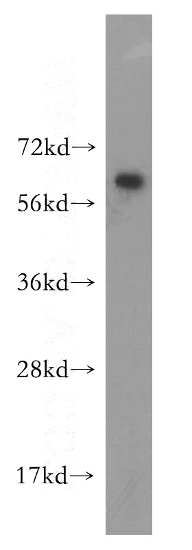 BxPC-3 cells were subjected to SDS PAGE followed by western blot with Catalog No:115490(SocS5 antibody) at dilution of 1:200