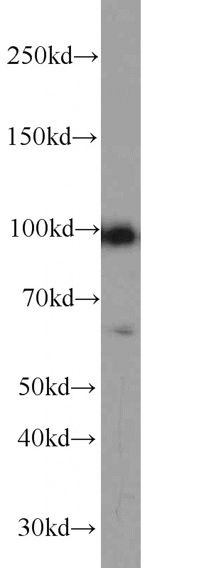 K-562 cells were subjected to SDS PAGE followed by western blot with Catalog No:110819(GADD34 antibody) at dilution of 1:600