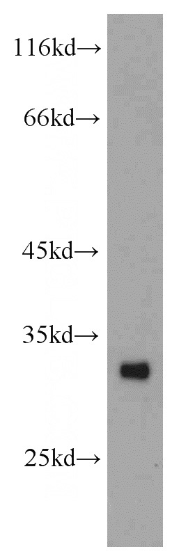 human heart tissue were subjected to SDS PAGE followed by western blot with Catalog No:108215(ASB8 antibody) at dilution of 1:100