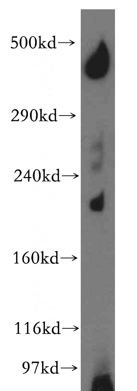 human brain tissue were subjected to SDS PAGE followed by western blot with Catalog No:109221(CHD9 antibody) at dilution of 1:300