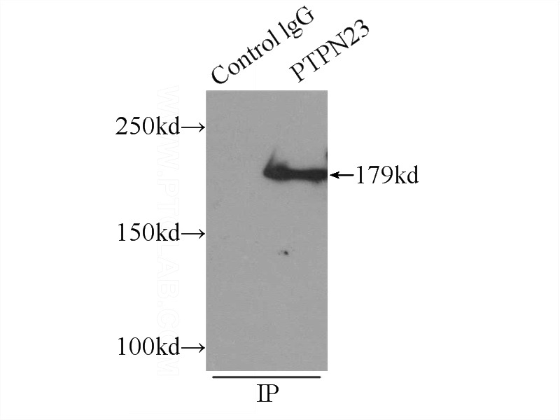 IP Result of anti-PTPN23 (IP:Catalog No:114320, 5ug; Detection:Catalog No:114320 1:500) with HeLa cells lysate 1000ug.