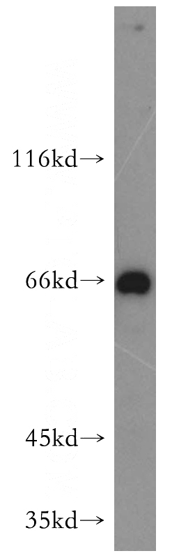 mouse kidney tissue were subjected to SDS PAGE followed by western blot with Catalog No:112438(MAPKAP1 antibody) at dilution of 1:500