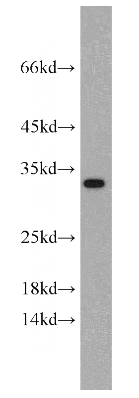 mouse liver tissue were subjected to SDS PAGE followed by western blot with Catalog No:108950(CBY1 antibody) at dilution of 1:500