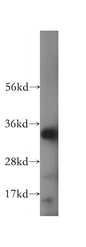 mouse liver tissue were subjected to SDS PAGE followed by western blot with Catalog No:111545(HSD17B11 antibody) at dilution of 1:800