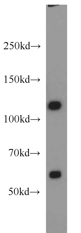 HeLa cells were subjected to SDS PAGE followed by western blot with Catalog No:114973(SART3 antibody) at dilution of 1:1000