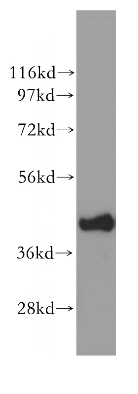mouse uterus tissue were subjected to SDS PAGE followed by western blot with Catalog No:110200(EIF3M antibody) at dilution of 1:500