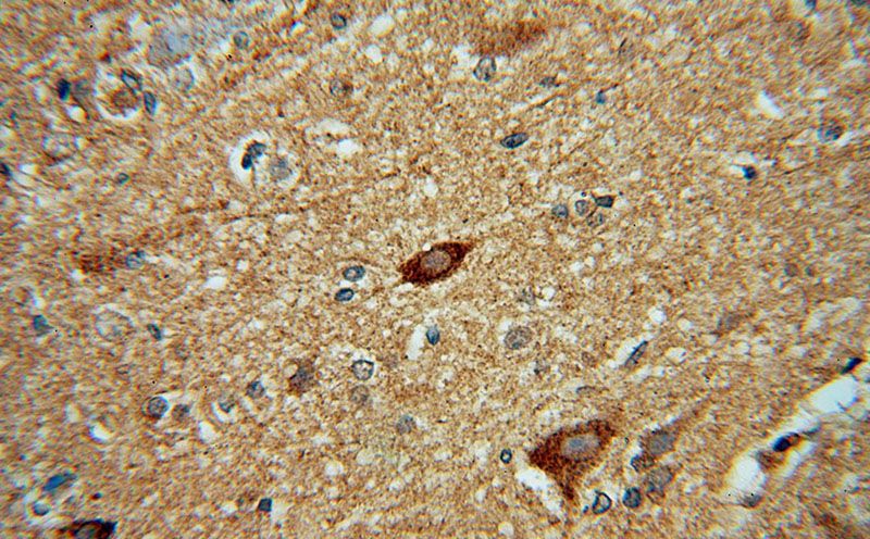 Immunohistochemical of paraffin-embedded human brain using Catalog No:111379(HDAC5-specific antibody) at dilution of 1:50 (under 40x lens)