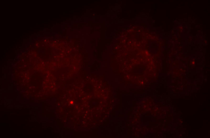 Immunofluorescent analysis of Hela cells, using SHFM1 antibody Catalog No:110030 at 1:25 dilution and Rhodamine-labeled goat anti-rabbit IgG (red).