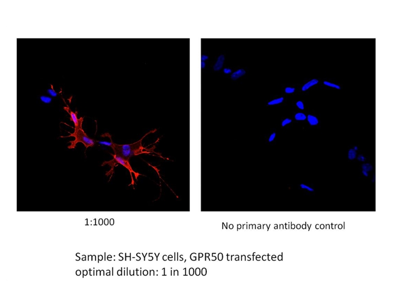 IF result of GPR50 antibody (Catalog No:111129, 1:1,000) with SH-SY5Y cells transfected with GPR50 by Dr. Qian Li, University of Edinburgh.