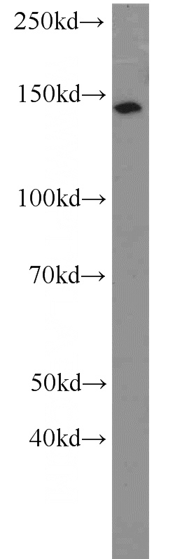 SH-SY5Y cells were subjected to SDS PAGE followed by western blot with Catalog No:112756(MPRIP antibody) at dilution of 1:800