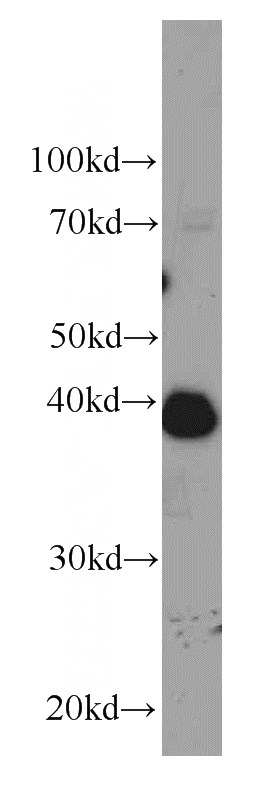 HEK-293 cells were subjected to SDS PAGE followed by western blot with Catalog No:107416(MBIP antibody) at dilution of 1:1000