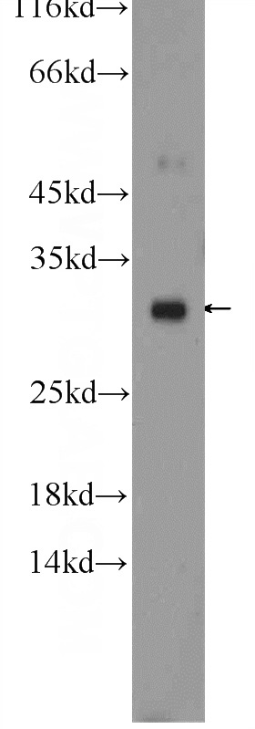 mouse liver tissue were subjected to SDS PAGE followed by western blot with Catalog No:110373(ERP29 Antibody) at dilution of 1:1000