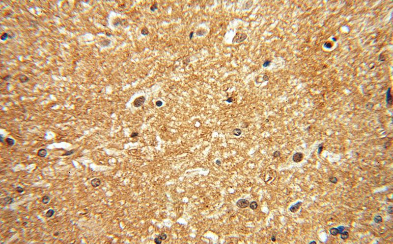 Immunohistochemical of paraffin-embedded human brain using Catalog No:109978(DISC1-long-specific antibody) at dilution of 1:50 (under 40x lens)