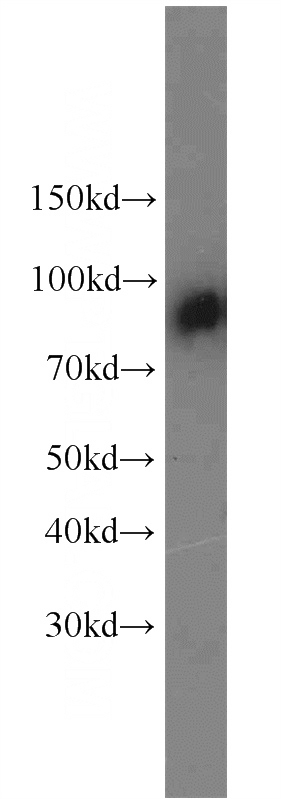 human blood tissue were subjected to SDS PAGE followed by western blot with Catalog No:108690(C1S antibody) at dilution of 1:2000