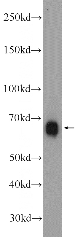 HeLa cells were subjected to SDS PAGE followed by western blot with Catalog No:110377(ESCO2 antibody) at dilution of 1:1000