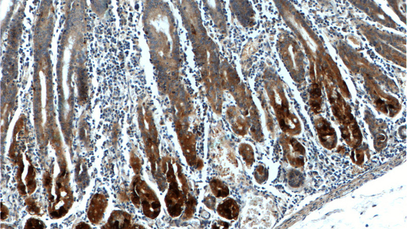 Immunohistochemistry of paraffin-embedded human stomach tissue slide using Catalog No:111123(GPR21 Antibody) at dilution of 1:100 (under 10x lens).