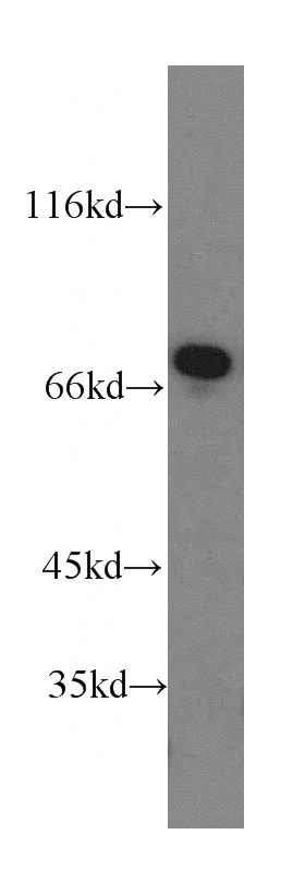 mouse brain tissue were subjected to SDS PAGE followed by western blot with Catalog No:113611(PXN antibody) at dilution of 1:1000