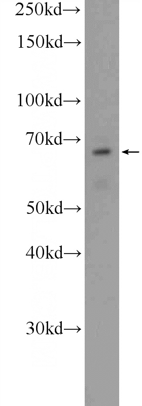 Y79 cells were subjected to SDS PAGE followed by western blot with Catalog No:109394(CLIP4 Antibody) at dilution of 1:600
