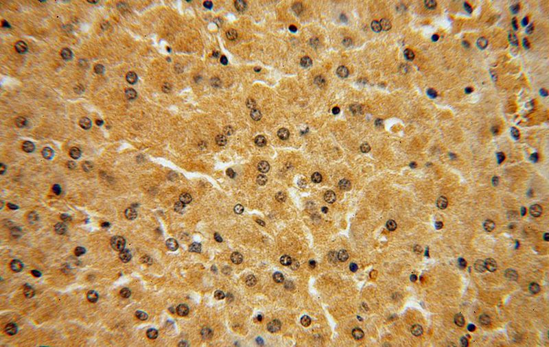 Immunohistochemical of paraffin-embedded human liver using Catalog No:112946(NAP1L4 antibody) at dilution of 1:100 (under 40x lens)