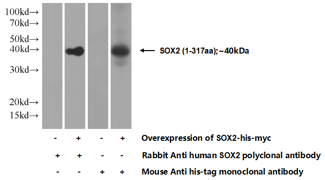 Transfected HEK-293 cells were subjected to SDS PAGE followed by western blot with Catalog No:115515(SOX2 Antibody) at dilution of 1:5000