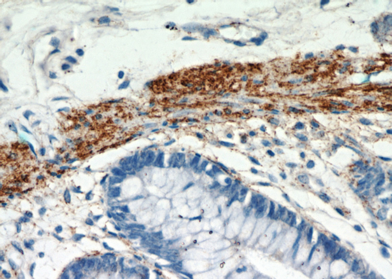 Immunohistochemical of paraffin-embedded human colon using Catalog No:112974(MYLK3 antibody) at dilution of 1:100 (under 40x lens)