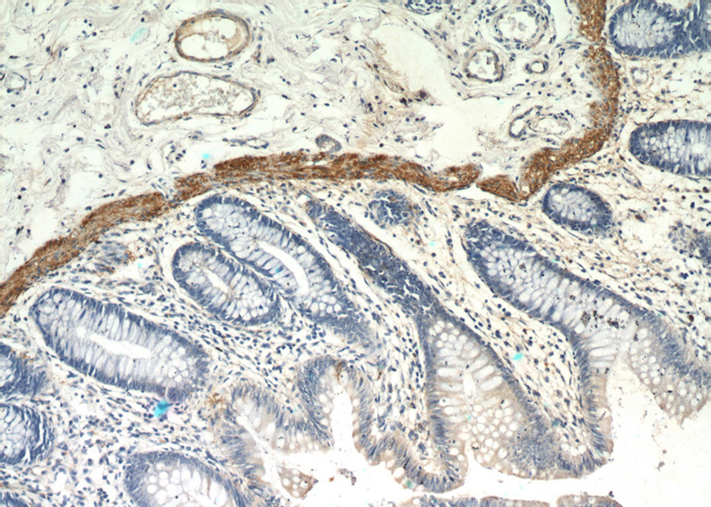 Immunohistochemical of paraffin-embedded human colon using Catalog No:112974(MYLK3 antibody) at dilution of 1:100 (under 10x lens)