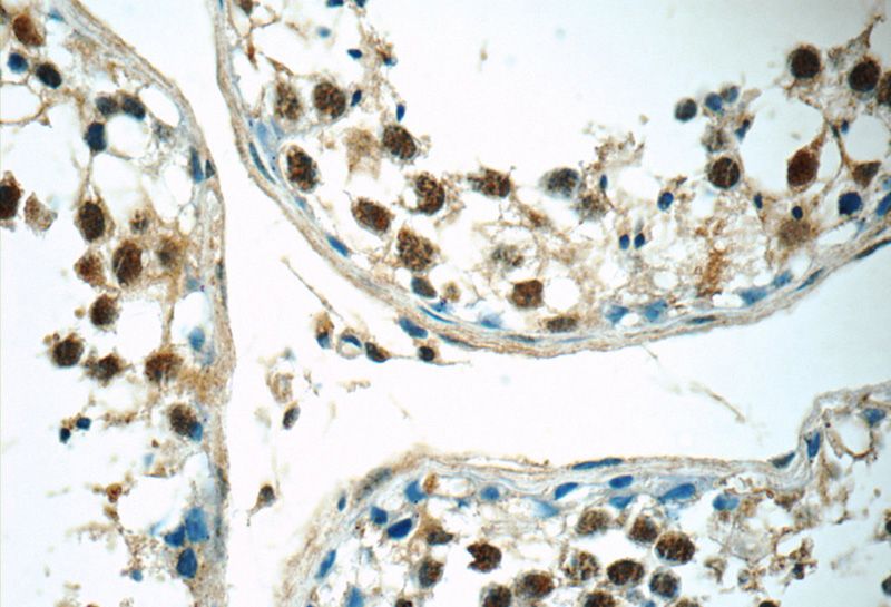 Immunohistochemistry of paraffin-embedded human testis tissue slide using Catalog No:114764(RNF8 Antibody) at dilution of 1:50 (under 40x lens)