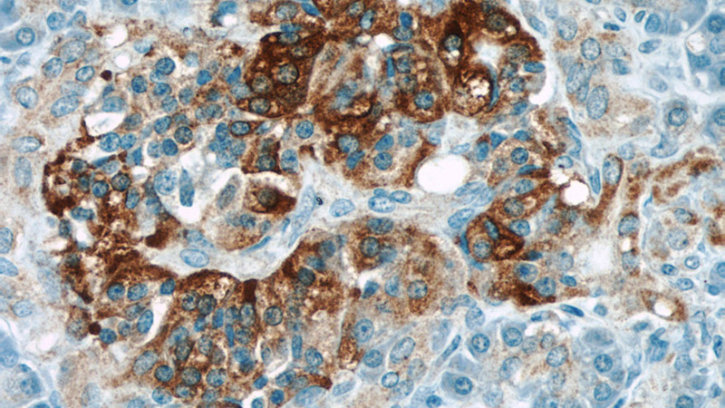 Immunohistochemical of paraffin-embedded human pancreas using Catalog No:114805(RPGRIP1L antibody) at dilution of 1:50 (under 40x lens)