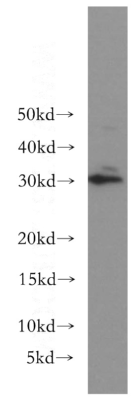 K-562 cells were subjected to SDS PAGE followed by western blot with Catalog No:117148(BIN3 antibody) at dilution of 1:300