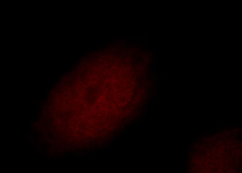 Immunofluorescent analysis of Hela cells, using RFWD3 antibody Catalog No:114633 at 1:50 dilution and Rhodamine-labeled goat anti-rabbit IgG (red).