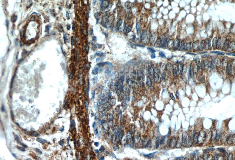 Immunohistochemistry of paraffin-embedded human colon tissue slide using Catalog No:114544(RANKL Antibody) at dilution of 1:50 (under 40x lens)